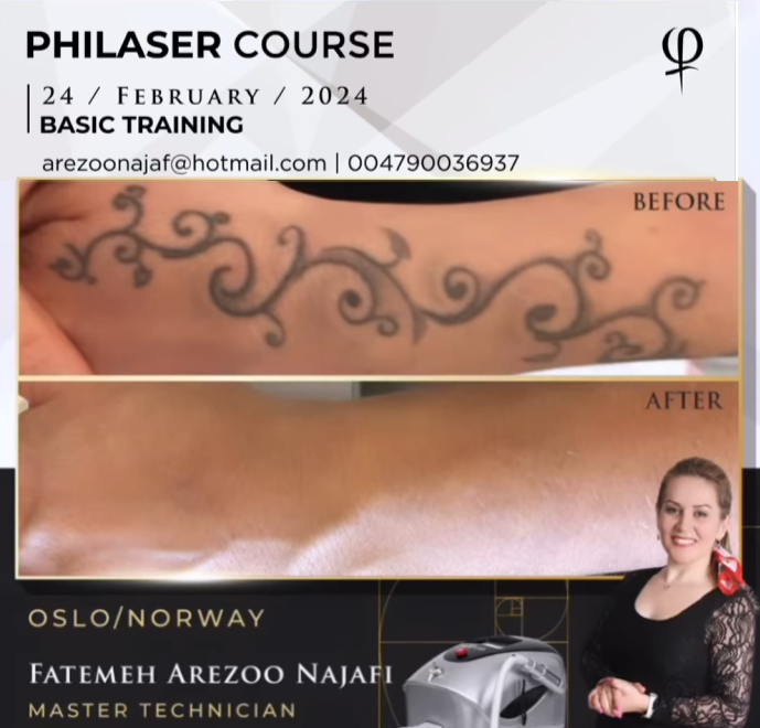 Phi Laser Course