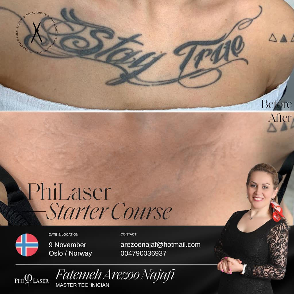 Phi Laser Course (OSLO)